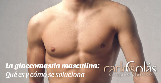 Solución a la ginecomastia masculina